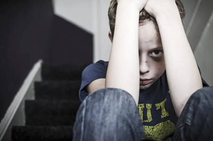 West Palm Beach Sexual Assault Attorney